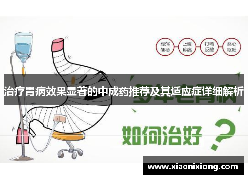 治疗胃病效果显著的中成药推荐及其适应症详细解析